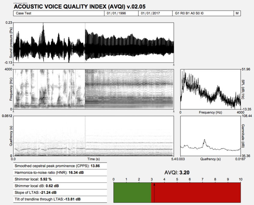cepstral voices license keys free cepstral voices license keys free