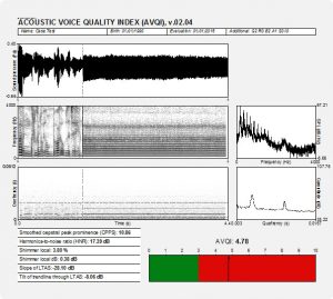 Phonanium Acoustic Voice Quality Index