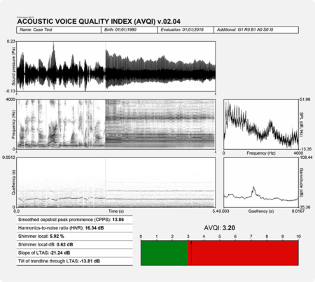 Phonanium Acoustic Voice Quality Index