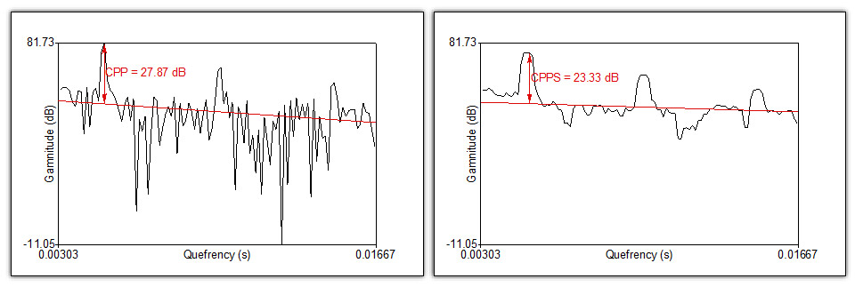 Phonanium Cepstrography Peaks